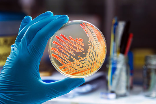 Microbiology Innovation Summit 2026